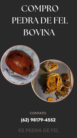 Pedra de fel bovina