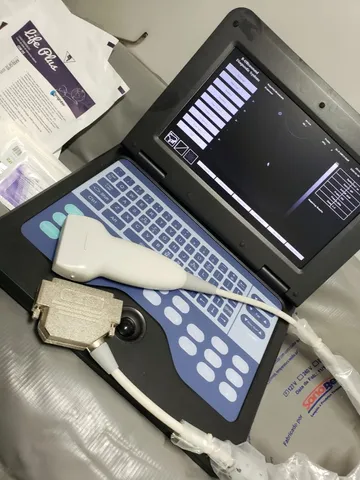 Aparelho de ultrassonografia portátil